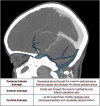 Fig. 12