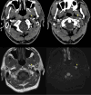 Fig. 8
