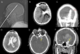Fig. 9