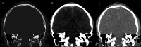 Fig. 15