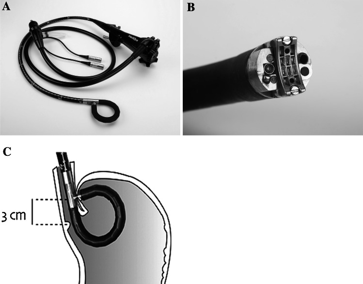 Fig. 1