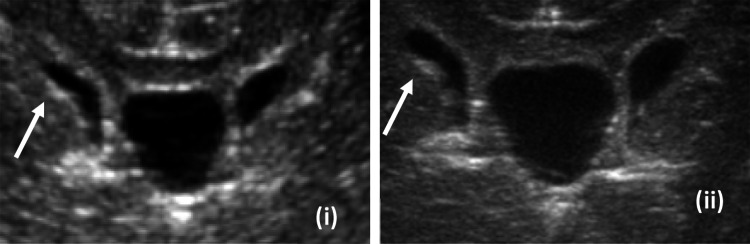 Fig. 12