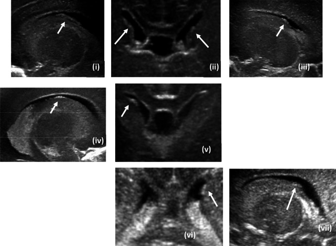 Fig. 10