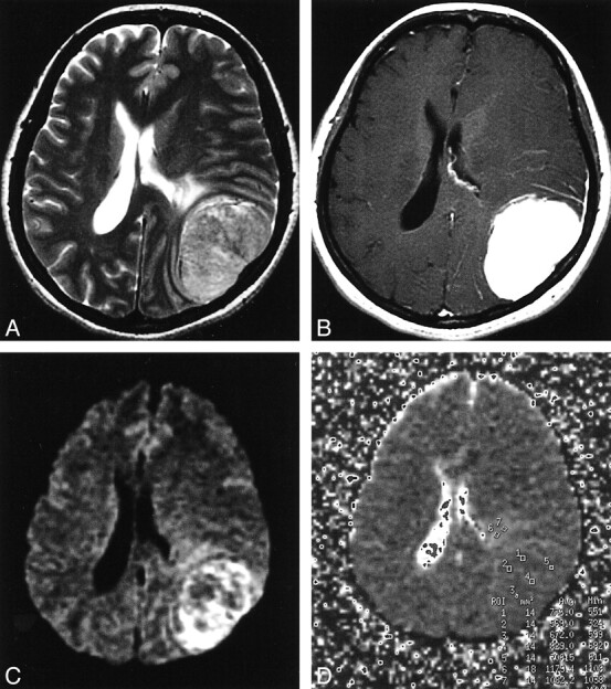 fig 5.