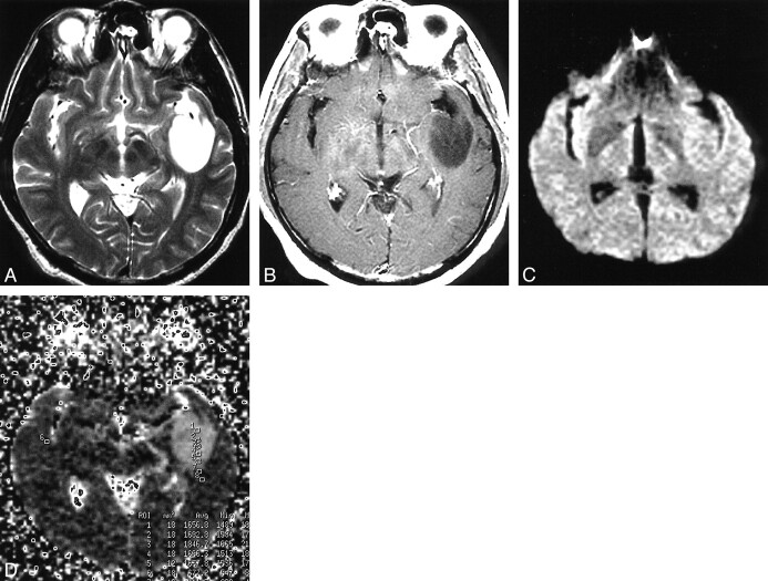 fig 2.