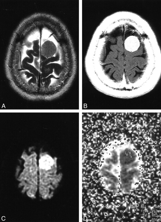 fig 4.