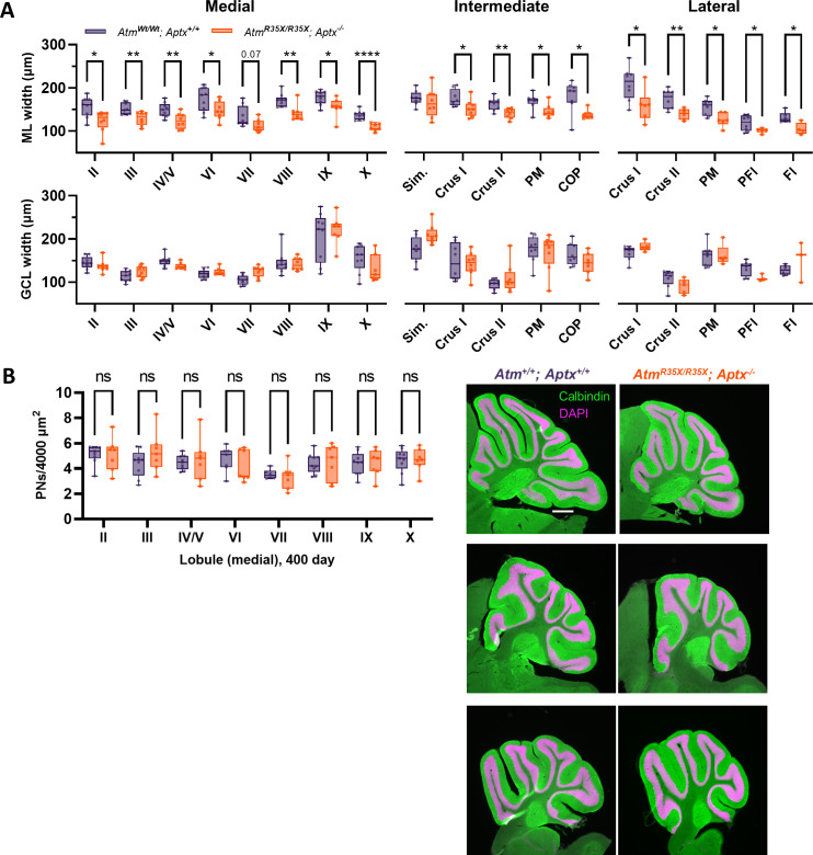 Figure 5—figure supplement 1.