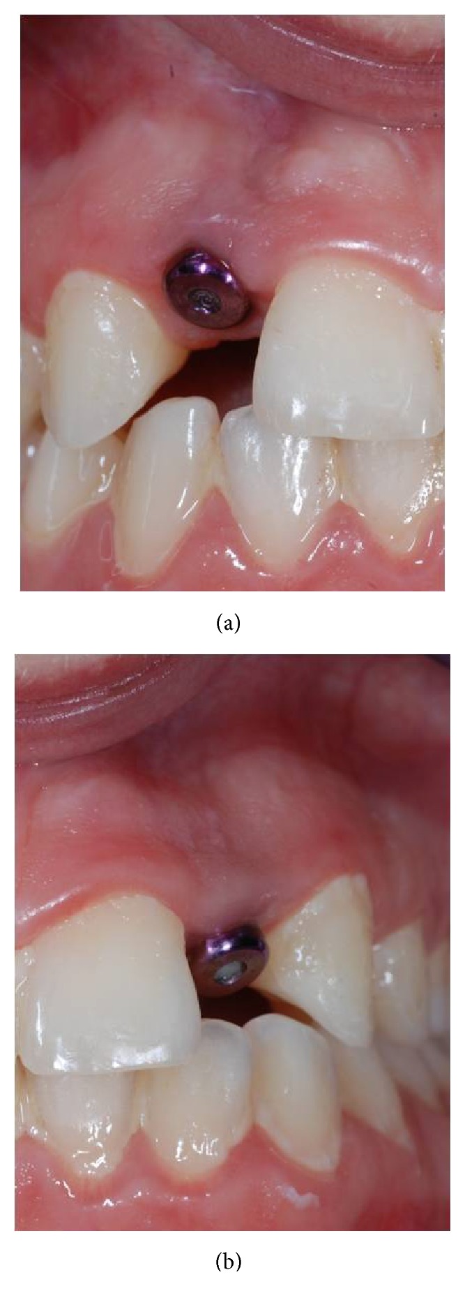 Figure 14