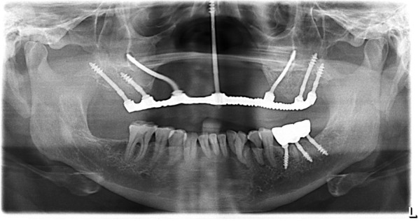 Fig. 11