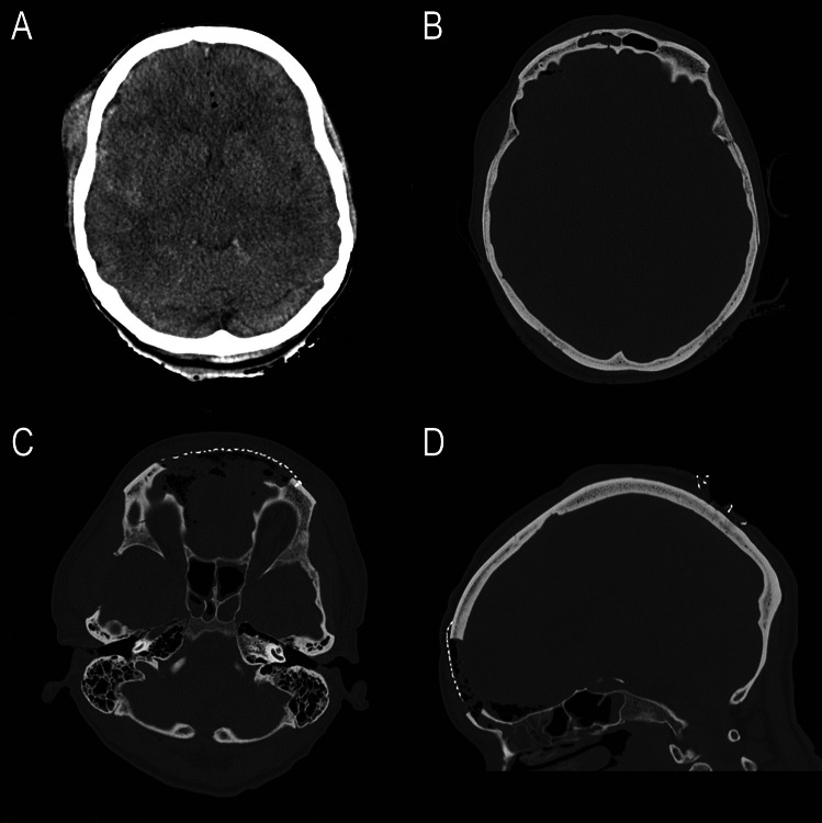 Fig. 2