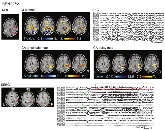 Fig. 4