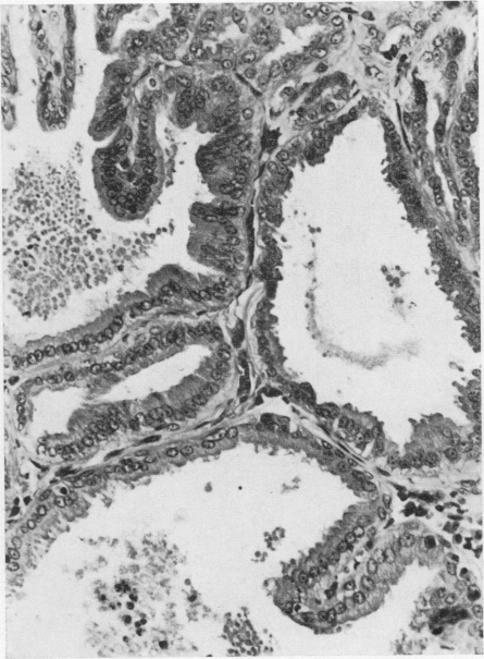 Fig. 19