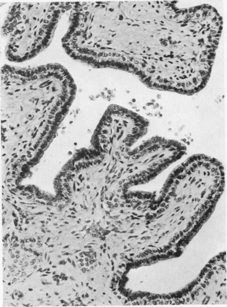 Fig. 18