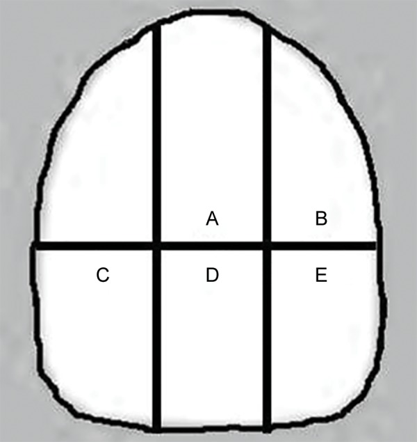 Figs 1A to E