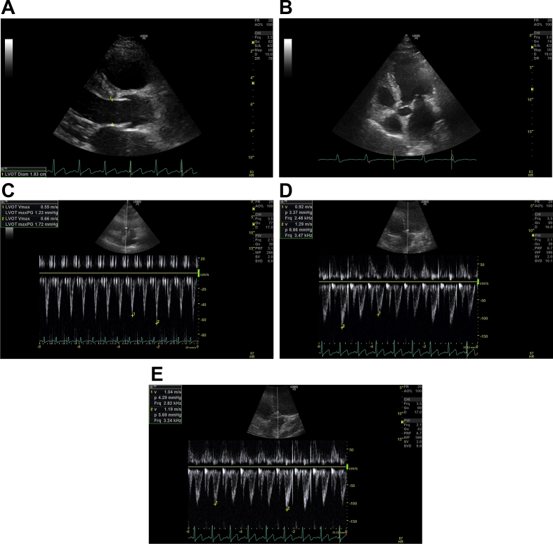 Fig 2