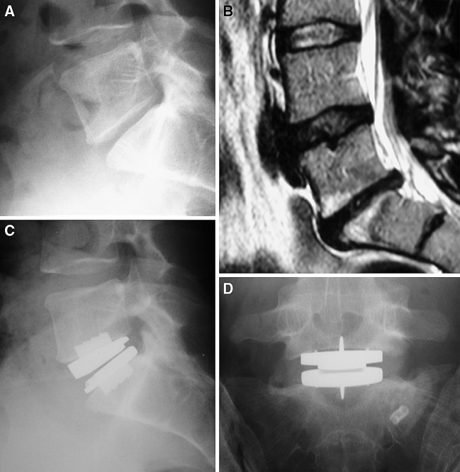 Fig. 2