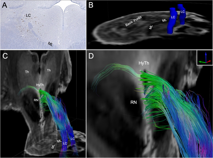 Fig. 10