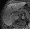 Figure 10a