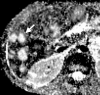 Figure 3c