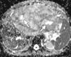 Figure 9d