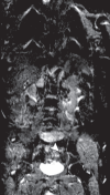 Figure 14b