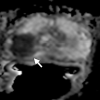 Figure 12b
