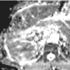 Figure 10c