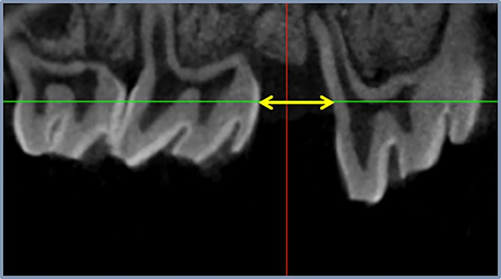 Fig 3