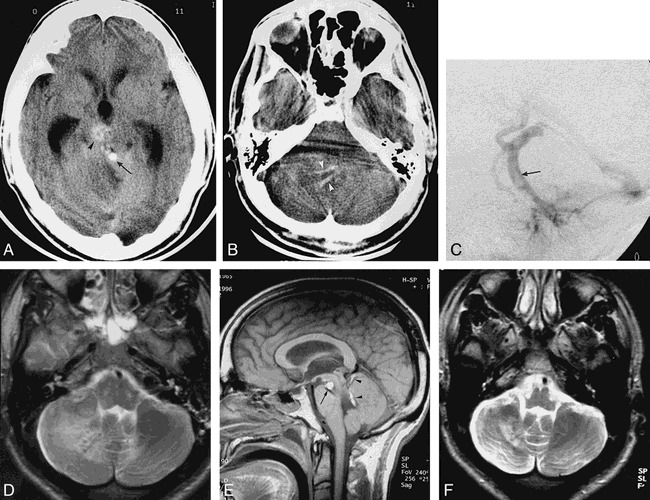 fig 1.