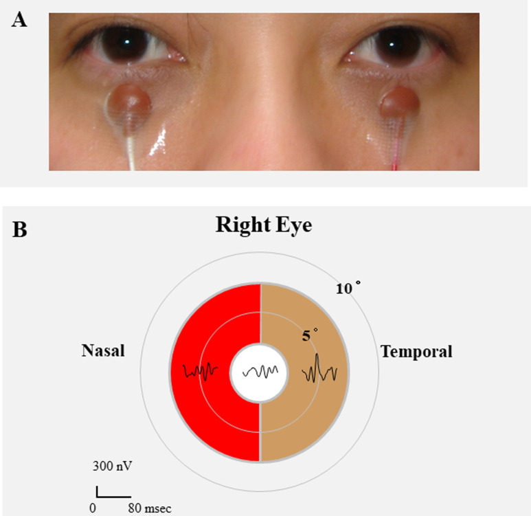 Fig 1