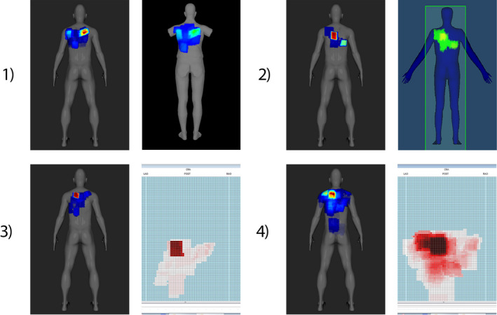 Fig. 10