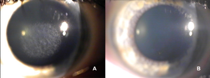 Fig. (1)