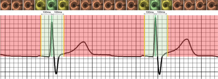 Fig. 2