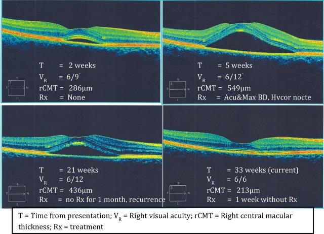 Figure 1