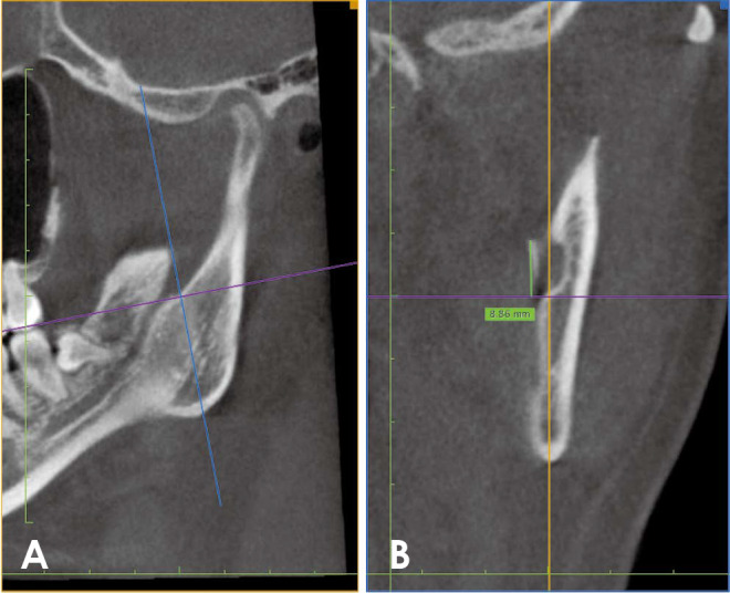 Fig. 5