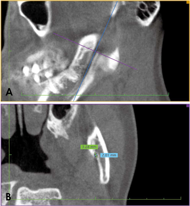 Fig. 4