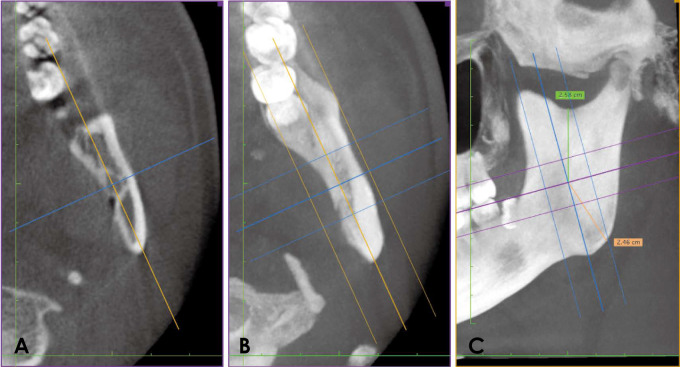 Fig. 3