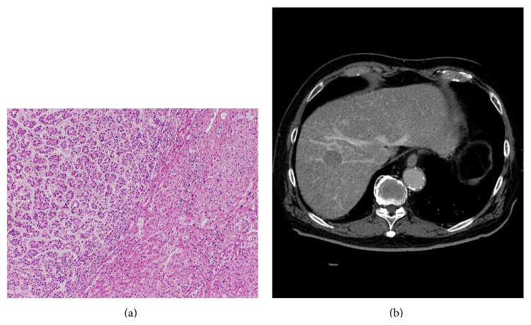 Figure 14