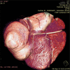 Fig. 14