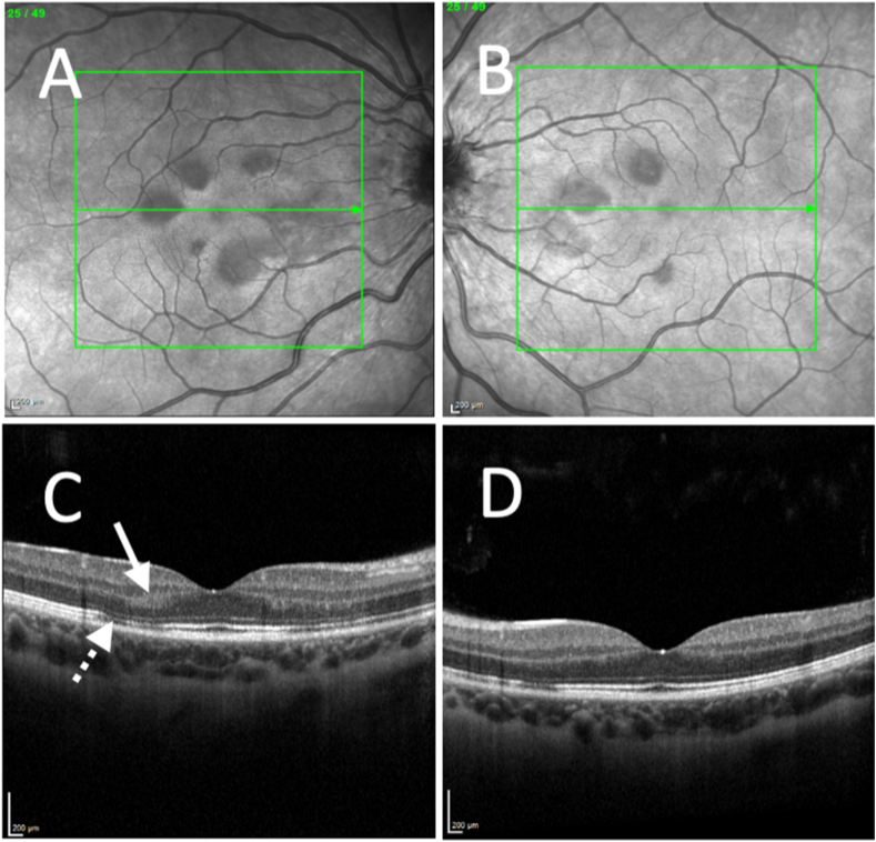 Fig. 2