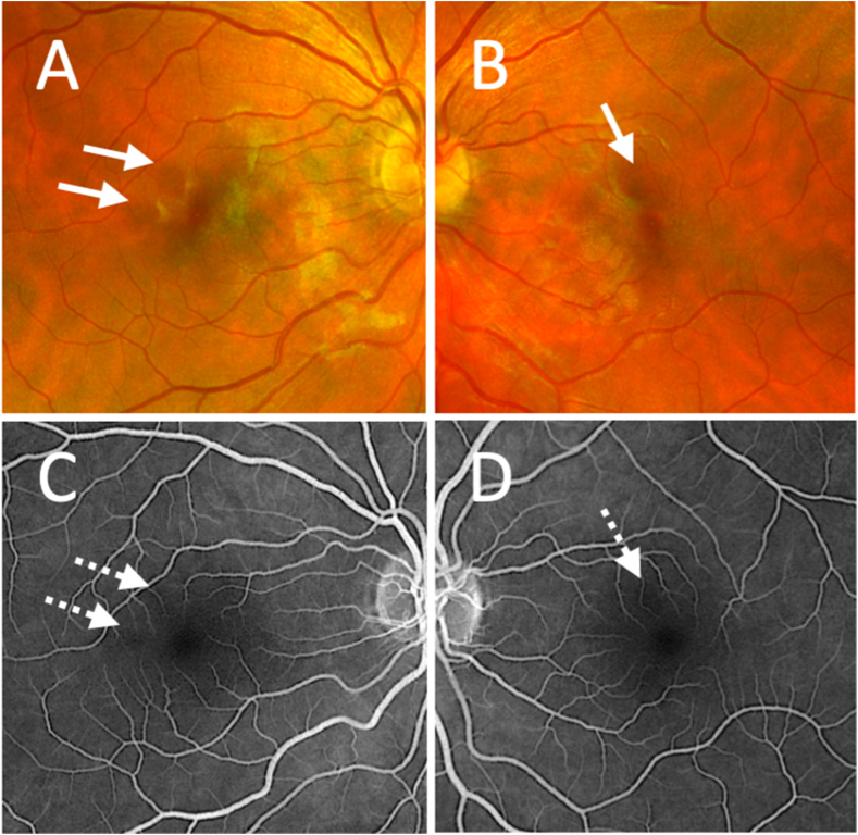 Fig. 1