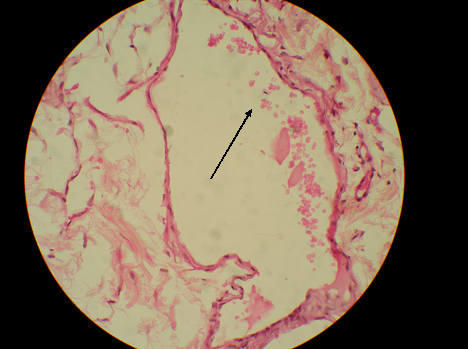 [Table/Fig-8]: