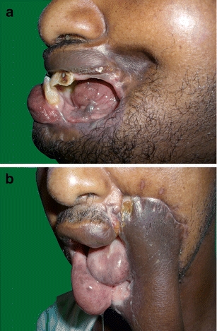 Fig. 1