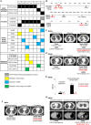 Figure 3. FGFR kinase domain mutations detected at progression on FGFR inhibitors in urothelial cancer. A, Heat map representing individual patient data among the cohort of FGFR3-driven urothelial cancers. B–G, Molecular and radiologic findings. Mutations and fusions in ctDNA are reported as variant allele frequencies (VAF). Mutations in the FGFR tyrosine kinase domain are reported in red. ampl, amplification. aPatient MR560 received erdafitinib combined with a PD-1 inhibitor. bPatient CTC1845 was treated with a sequence of erdafitinib–futibatinib (with intervening immunotherapy between the two FGFR inhibitors) before the ctDNA sample was collected at progression on futibatinib.