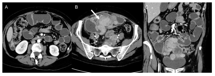 Figure 11