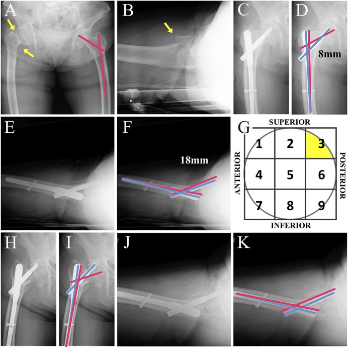 Fig. 3