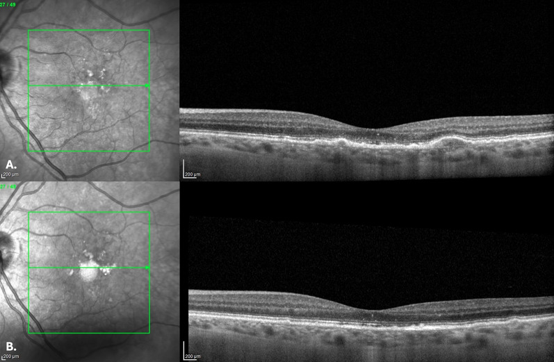 Fig. 4