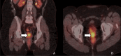 Fig 12