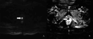 Fig 8