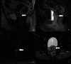 Fig 11
